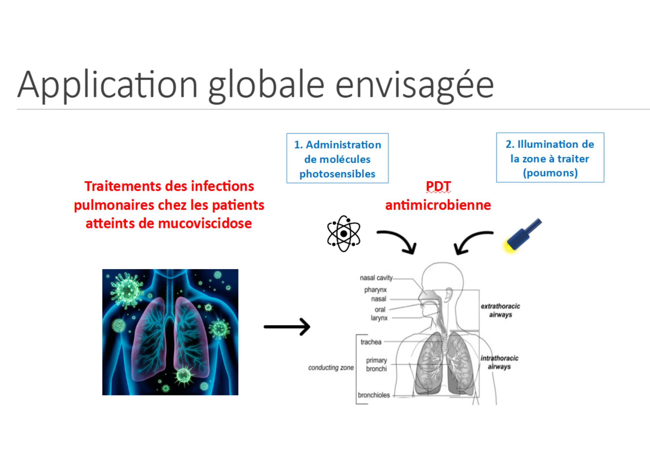 Technologie photonique antimicrobienne : Evosens participe à un projet de thérapie ciblée avec l’INSERM